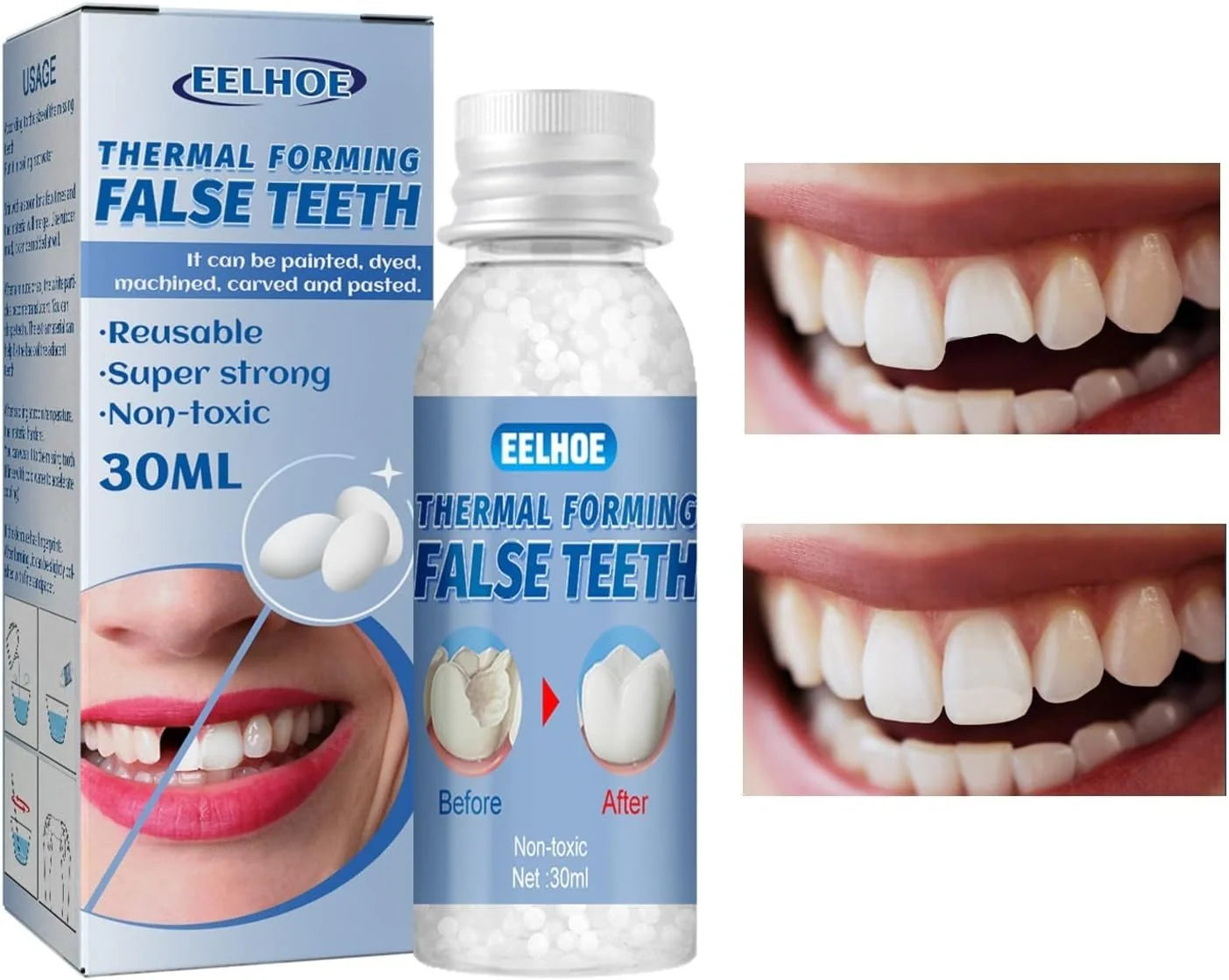 Nuevo Kit de Reparación Dental®: ¡Recupera tu sonrisa perfecta y tu confianza al instante sin ir al dentista!