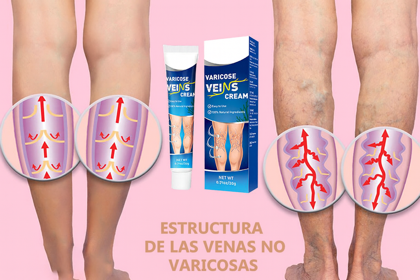 Crema Varicell: Despídete de las Arañitas y la Vergüenza, y Olvídate del Dolor ¡Piernas Perfectas en Pocas Semanas!