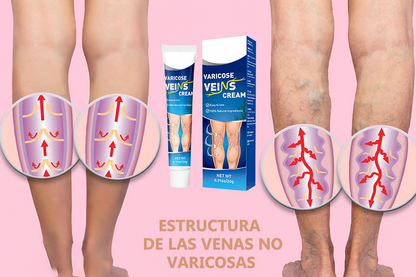Crema Varicell: Despídete de las Arañitas y la Vergüenza, y Olvídate del Dolor ¡Piernas Perfectas en Pocas Semanas!
