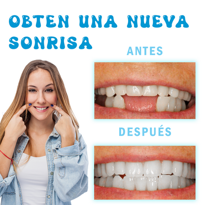 Nueva resina moldeadora: Recupera tu sonrisa sin gastar fortunas en el dentista