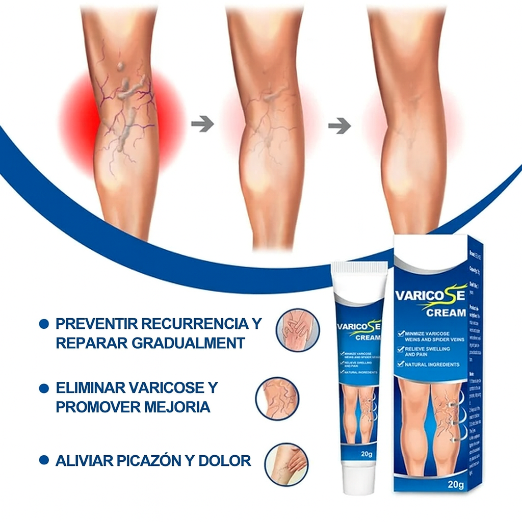 Crema Varicell: Despídete de las Arañitas y la Vergüenza, y Olvídate del Dolor ¡Piernas Perfectas en Pocas Semanas!