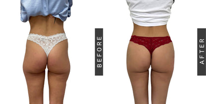 Gomitas CBB: El Secreto para un Trasero de Impacto en Solo Semanas Ha Llegado