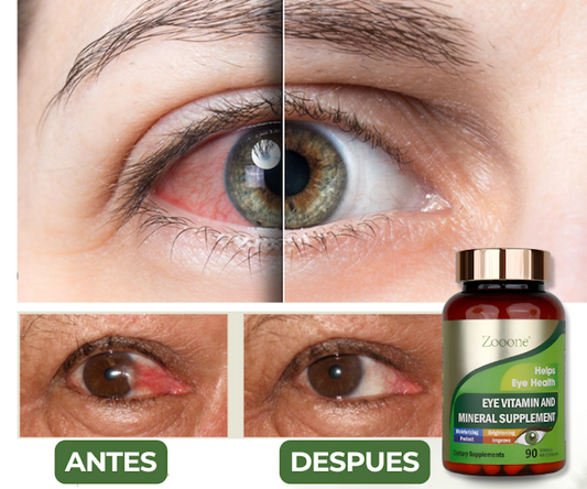 ZOONE VITAMINAS® – Alivia ojos secos, rojos y cansados, restaura tu visión en semanas.