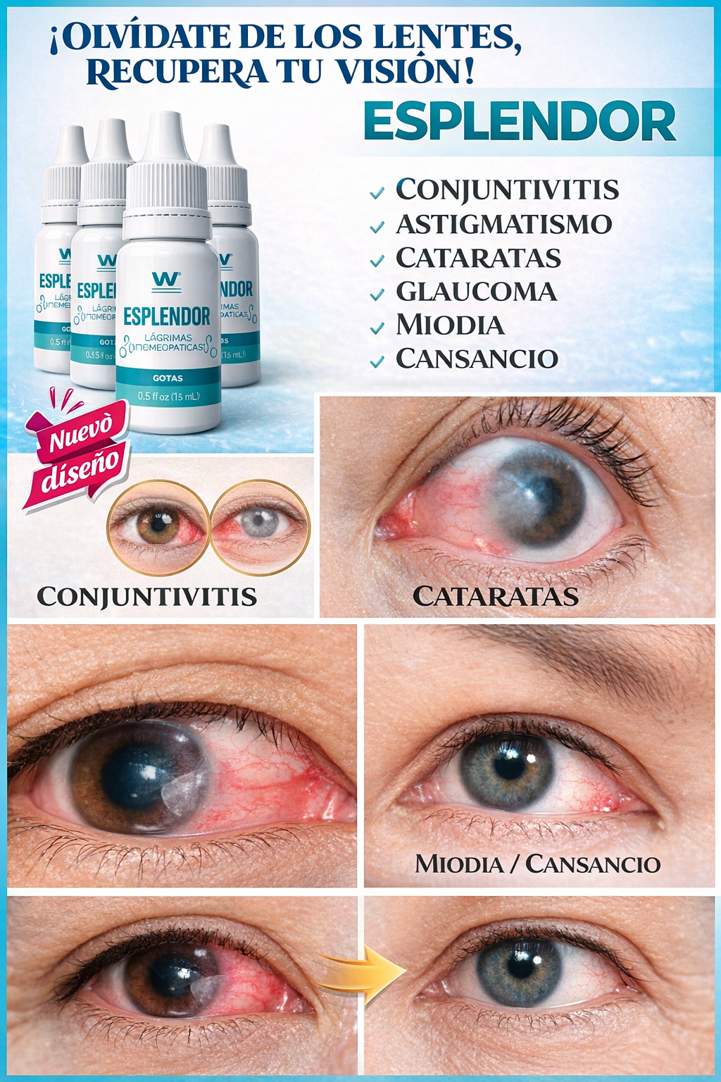 ESPLENDOR VISION® – Gotas Naturales para una Vista Más Clara y Descansada