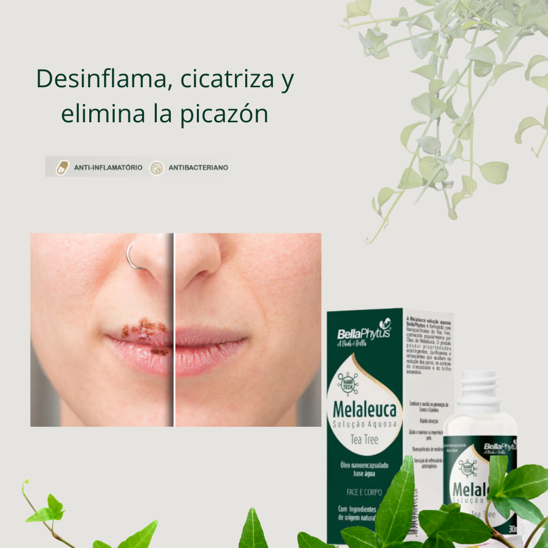 ¡Basta de Vergüenza! Elimina Herpes, Hongos e Infecciones Rápidamente y Protege tu Piel de Recaídas