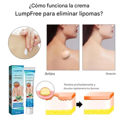 ¡Basta de Bultos! Elimina Lipomas, Fibromas y Protuberancias Grasas sin Cirugía Dolorosa en Semanas