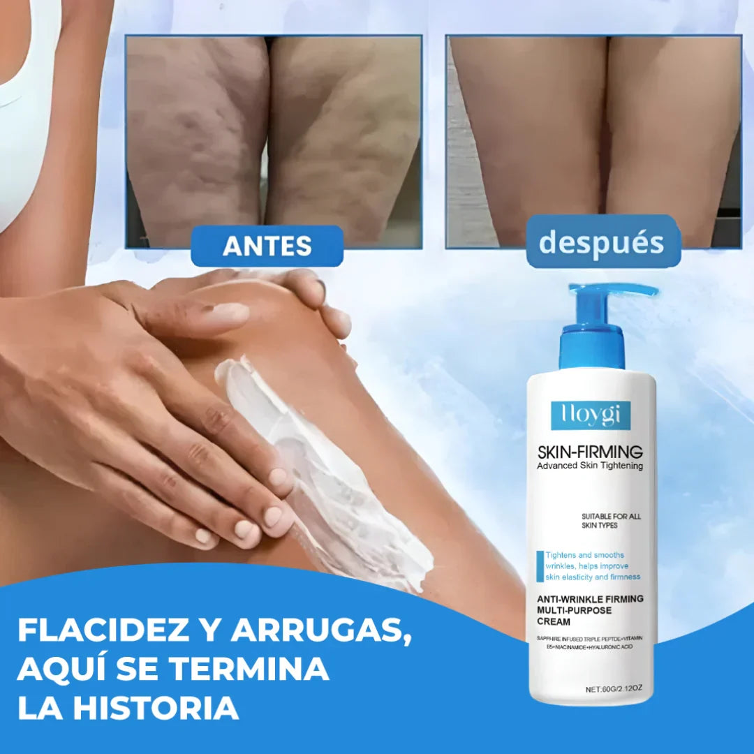 Crema Reafirmante Hoygi®: Recupera la firmeza y juventud de tu piel en SOLO 15 días