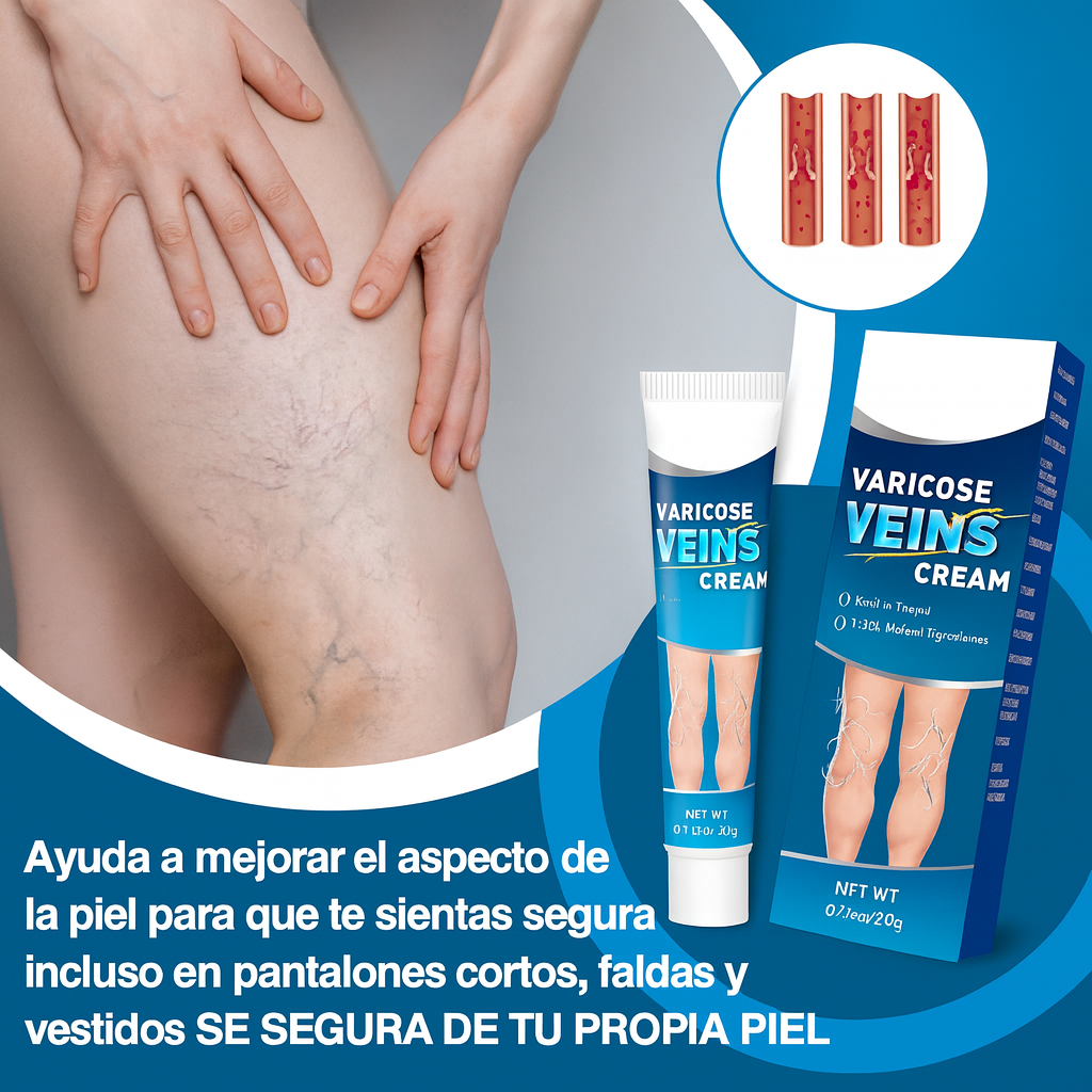 Crema Varicell: Despídete de las Arañitas y la Vergüenza, y Olvídate del Dolor ¡Piernas Perfectas en Pocas Semanas!