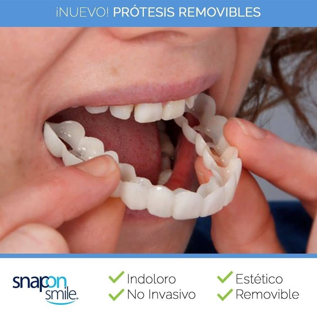 ¡Basta de Ocultarte! Obtén una Sonrisa Perfecta al Instante y Recupera tu Confianza sin Dolor ni Costos