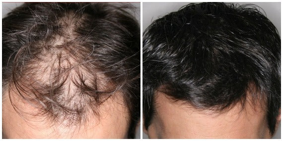 Aceite de Batana 100% Puro: ¡Revierte la caída y recupera un cabello visiblemente más grueso y abundante en solo 30 días!